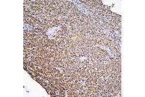 IHC analysis of PHF21A using anti-PHF21A antibody (ABIN6719353).