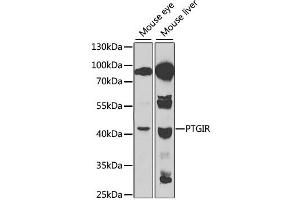 Western blot analysis of extracts of various cell lines, using PTGIR antibody. (Prostacyclin Receptor Antikörper)