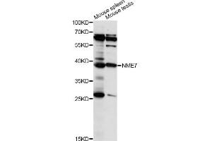 Western blot analysis of extracts of various cell lines, using NME7 antibody (ABIN6293928) at 1:1000 dilution.