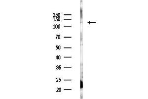 Western blot analysis of lysates from Rat lung, using CRM1 Antibody at 1/1000 dilution.