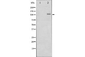 Western Blotting (WB) image for anti-Nuclear Factor of kappa Light Polypeptide Gene Enhancer in B-Cells 2 (NFKB2) (pSer866) antibody (ABIN6256439)
