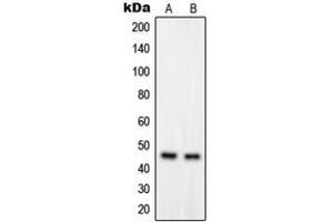Western Blotting (WB) image for anti-G Protein-Coupled Receptor, Family C, Group 5, Member B (GPRC5B) (Center) antibody (ABIN7298178)