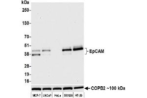 Western Blotting (WB) image for anti-Epithelial Cell Adhesion Molecule (EPCAM) (AA 24-265) antibody (ABIN7453970) (Rekombinanter EpCAM Antikörper  (AA 24-265))