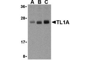 Western Blotting (WB) image for anti-Tumor Necrosis Factor (Ligand) Superfamily, Member 15 (TNFSF15) (N-Term) antibody (ABIN1031618) (TNFSF15 Antikörper  (N-Term))