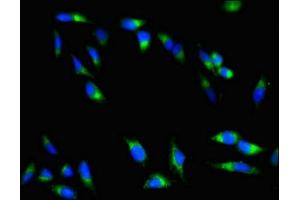Immunofluorescent analysis of Hela cells using ABIN7147742 at dilution of 1:100 and Alexa Fluor 488-congugated AffiniPure Goat Anti-Rabbit IgG(H+L) (Chymotrypsin Antikörper  (AA 90-220))