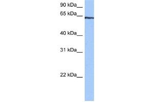 WB Suggested Anti-TTC6 Antibody Titration:  0. (TTC6 Antikörper  (C-Term))