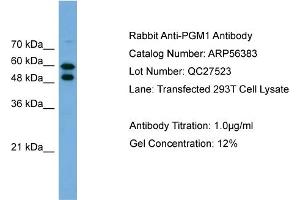 Western Blotting (WB) image for anti-Phosphoglucomutase 1 (PGM1) (Middle Region) antibody (ABIN785805) (Phosphoglucomutase 1 Antikörper  (Middle Region))