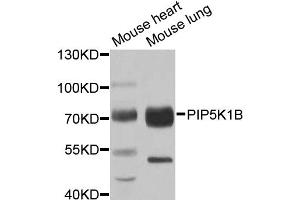 Western blot analysis of extracts of various cell lines, using PIP5K1B antibody. (PIP5K1B Antikörper)