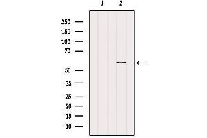 Western Blotting (WB) image for anti-Potassium Voltage-Gated Channel, Delayed-Rectifier, Subfamily S, Member 1 (KCNS1) (C-Term) antibody (ABIN6262759)