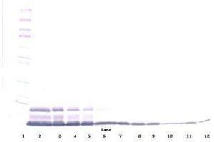 Image no. 2 for anti-Interleukin 8 (IL8) antibody (ABIN465358) (IL-8 Antikörper)