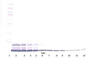Image no. 2 for anti-Interleukin 8 (IL8) antibody (ABIN465357) (IL-8 Antikörper)
