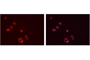 ABIN6277388 staining Hela cells by IF/ICC. (IGFBP7 Antikörper  (Internal Region))