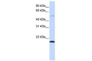Western Blot showing ZNF683 antibody used at a concentration of 1-2 ug/ml to detect its target protein. (ZNF683 Antikörper  (N-Term))