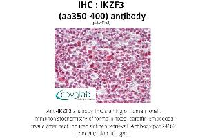 Image no. 1 for anti-IKAROS Family Zinc Finger 3 (Aiolos) (IKZF3) (AA 350-400) antibody (ABIN1735871) (IKZF3 Antikörper  (AA 350-400))