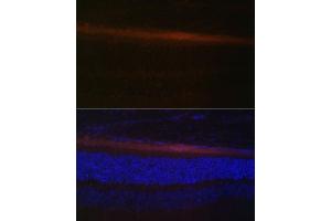 Immunofluorescence analysis of rat retina using RDH5 Polyclonal Antibody (ABIN6130851, ABIN6146839, ABIN6146840 and ABIN6224076) at dilution of 1:100 (40x lens). (RDH5 Antikörper  (AA 24-318))