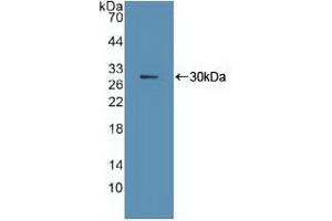Detection of Recombinant Ki67P, Human using Polyclonal Antibody to Ki-67 Protein (Ki-67) (Ki-67 Antikörper  (AA 3088-3235))