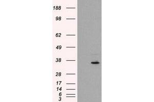 HEK293T cells were transfected with the pCMV6-ENTRY control (Left lane) or pCMV6-ENTRY FAHD2A (Right lane) cDNA for 48 hrs and lysed. (FAHD2A Antikörper)