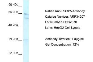 WB Suggested Anti-RBBP5 Antibody Titration:  0. (RBBP5 Antikörper  (Middle Region))