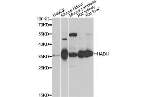 Western blot analysis of extracts of various cell lines, using HADH antibody. (HADH Antikörper)