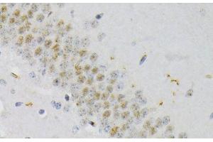 Immunohistochemistry of paraffin-embedded Mouse brain using Phospho-CREB1(S133) Polyclonal Antibody at dilution of 1:200 (40x lens).