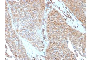 Immunohistochemistry (IHC) image for anti-SERPINE1 mRNA Binding Protein 1 (SERBP1) (AA 3-139) antibody (ABIN6939487)