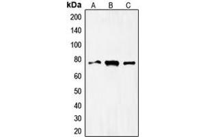 Western blot analysis of FOXO1 expression in HeLa (A), MCF7 (B), Jurkat (C) whole cell lysates.