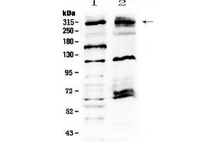 Western blot analysis of MED13 using anti-MED13 antibody . (MED13 Antikörper  (AA 61-240))
