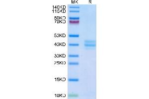 Mouse GPA33 on Tris-Bis PAGE under reduced condition. (GPA33 Protein (AA 22-235) (His tag))