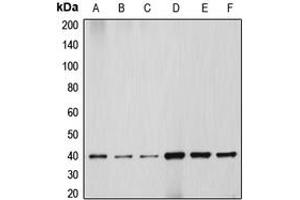 Western blot analysis of HSP40 expression in HEK293T (A), HeLa (B), NIH3T3 (C), PC12 (D), Jurkat (E), HepG2 (F) whole cell lysates. (DNAJB1 Antikörper  (C-Term))