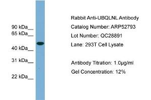 WB Suggested Anti-UBQLNL  Antibody Titration: 0. (UBQLNL Antikörper  (Middle Region))