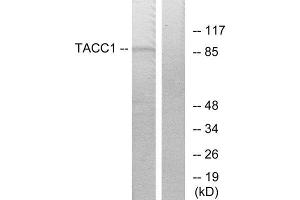 Western Blotting (WB) image for anti-Transforming, Acidic Coiled-Coil Containing Protein 1 (TACC1) (N-Term) antibody (ABIN1849024) (TACC1 Antikörper  (N-Term))