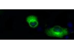 Image no. 3 for anti-Amyloid beta (A4) Precursor Protein (APP) antibody (ABIN1496878) (APP Antikörper)