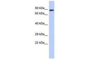 Image no. 1 for anti-Zinc Finger, FYVE Domain Containing 20 (ZFYVE20) (N-Term) antibody (ABIN6742873)