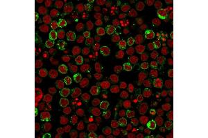 Immunofluorescence (IF) image for anti-Major Histocompatibility Complex, Class II, DR beta 1 (HLA-DRB1) antibody (ABIN6939640)