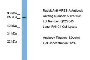 WB Suggested Anti-MRE11A  Antibody Titration: 0. (Mre11 Antikörper  (Middle Region))