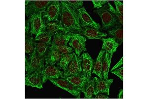 Immunofluorescent staining of methanol-fixed HeLa cells. (Cytokeratin 7 Antikörper)