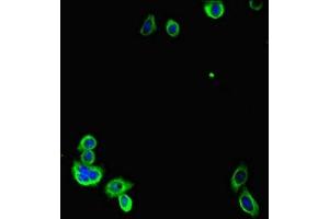 Immunofluorescent analysis of HepG2 cells using ABIN7153916 at dilution of 1:100 and Alexa Fluor 488-congugated AffiniPure Goat Anti-Rabbit IgG(H+L) (Glucose-6-Phosphate Dehydrogenase Antikörper  (AA 80-185))