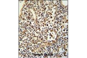 ANO5 Antibody (C-term) (ABIN652521 and ABIN2842350) immunohistochemistry analysis in formalin fixed and paraffin embedded human lymph tissue followed by peroxidase conjugation of the secondary antibody and DAB staining. (Anoctamin 5 Antikörper  (C-Term))