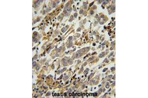 Immunohistochemistry (Paraffin-embedded Sections) (IHC (p)) image for anti-Ankyrin Repeat and SOCS Box Containing 17 (ASB17) (AA 184-214), (C-Term) antibody (ABIN950528)