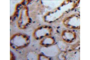 Used in DAB staining on fromalin fixed paraffin-embedded kidney tissue (PKC alpha Antikörper  (AA 339-597))