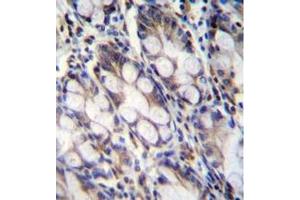 Immunohistochemistry analysis in formalin fixed and paraffin embedded human rectum tissue reacted with FNDC7 Antibody (C-term) followed by peroxidase conjugation of the secondary antibody and DAB staining.
