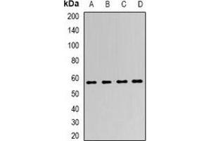 Western blot analysis of LSF expression in SKOV3 (A), K562 (B), mouse kidney (C), mouse brain (D) whole cell lysates.