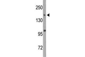 Western blot analysis of Dnmt1 antibody and MDA-MB435 lysate.