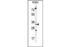 Western Blotting (WB) image for anti-Pyrroline-5-Carboxylate Reductase Family, Member 2 (PYCR2) (AA 96-124), (Middle Region) antibody (ABIN954394)