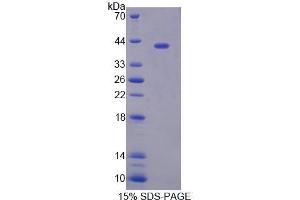 SDS-PAGE analysis of Human TSTA3 Protein. (TSTA3 Protein)