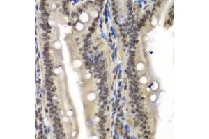 Immunohistochemistry of paraffin-embedded mouse Intestine using NELFE antibody at dilution of 1:100 (x40 lens). (RDBP Antikörper)