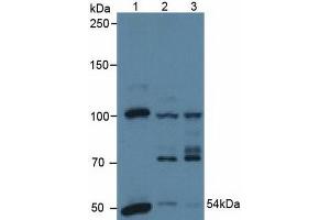 Western blot analysis of (1) Human A431 Cells, (2) Human HeLa cells and (3) Porcine Heart Tissue. (PDHX Antikörper  (AA 220-468))
