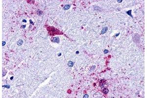 Anti-EDG7 antibody  ABIN1048536 IHC staining of human brain, amygdala. (LPAR3 Antikörper  (Cytoplasmic Domain))