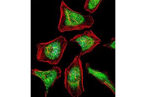 Fluorescent confocal image of Hela cell stained with ATF7 Antibody (N-term). (AFT7 Antikörper  (N-Term))
