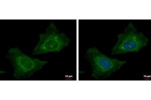 ICC/IF Image RABGGTB antibody detects RABGGTB protein at cytoplasm by immunofluorescent analysis. (RABGGTB Antikörper)